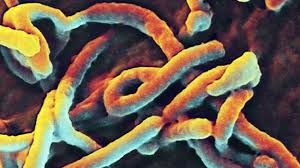 Ảnh 2 của Ebola